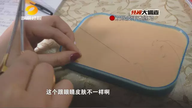 揭非法微整形:用牙签量顾客眼皮 厕所门口做手术