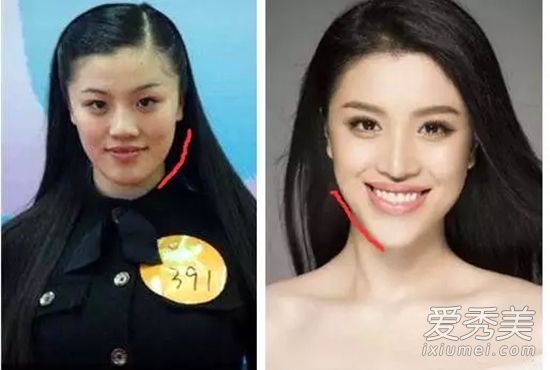 刘翔前妻VS前女友 葛天吴莎整容撞脸太尴尬(组图)